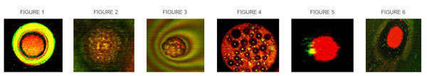 MICROGRAPH 1 TO 6